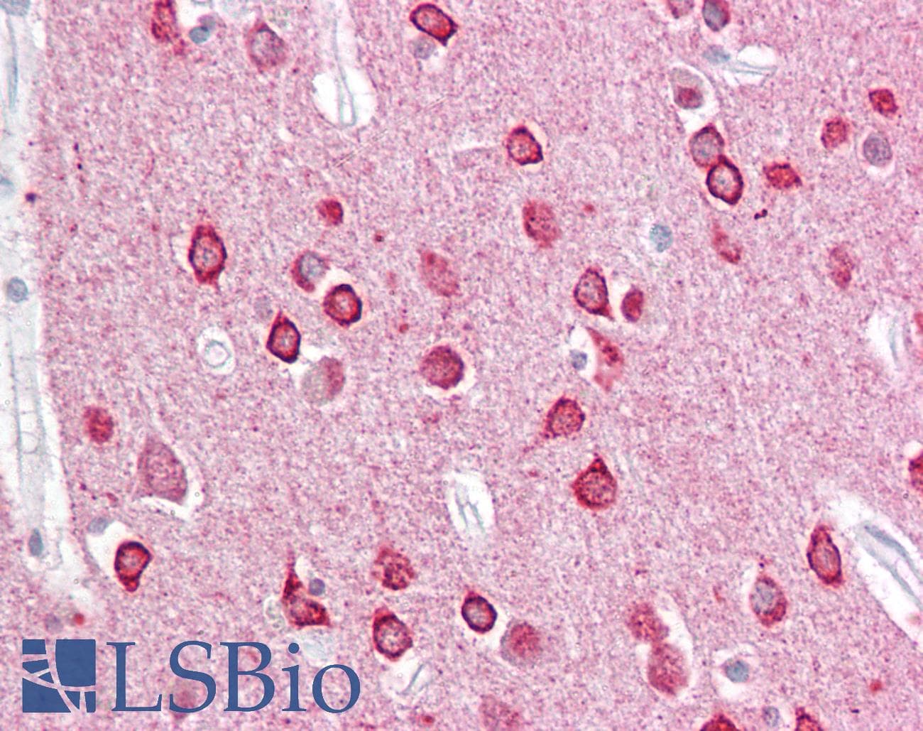 IHC-plus™ Polyclonal Goat anti-Human Syndapin I / PACSIN1 Antibody (aa2-15, IHC, WB)