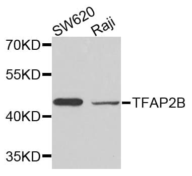 TFAP2B / AP2 Beta Antibody (AP)
