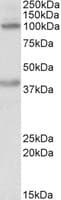 IHC-plus™ ZEB2 / SIP-1 Antibody (aa521-534)