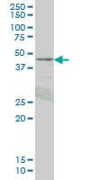 PRKAR1B Antibody (clone 1F8)