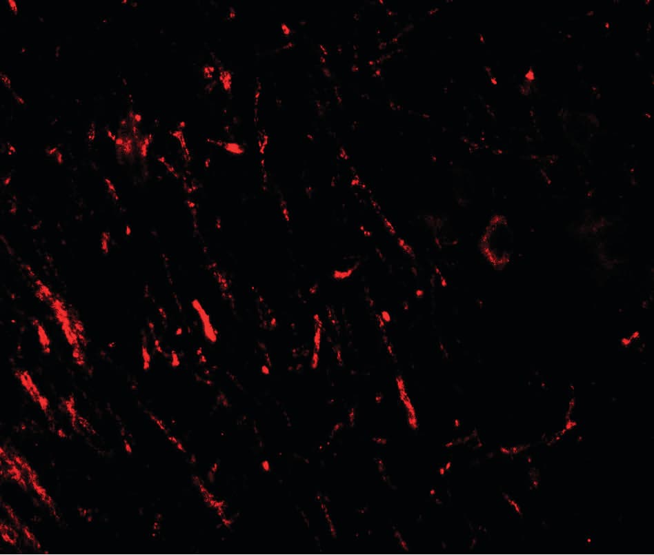 AKT1S1 / PRAS40 Antibody