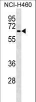 Polyclonal Rabbit anti-Human DCT / Dopachrome Tautomerase Antibody (aa286-314, WB)