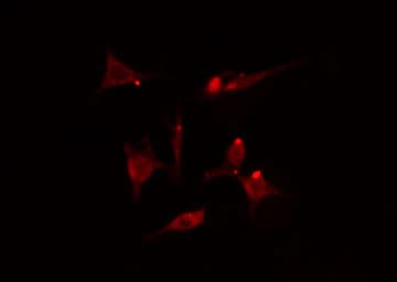 YWHAB / 14-3-3 Beta Antibody