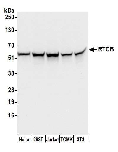 RTCB / C22orf28 Antibody (aa175-225)