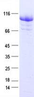 Human CTNNB1 / Beta Catenin Protein (Recombinant His, N-Terminal)