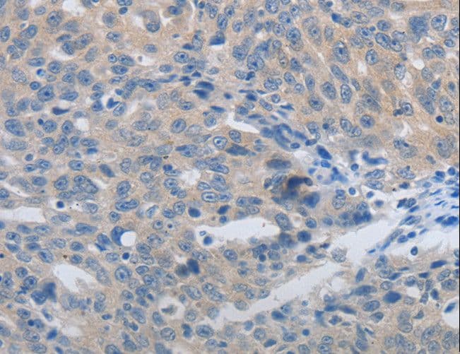 Polyclonal Rabbit anti-Human MMP8 Antibody (IHC, WB)