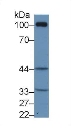 TP / Thymidine Phosphorylase Antibody (aa3-324, PE)