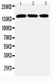 ATXN2 / SCA2 / Ataxin-2 Antibody (aa1293-1313)