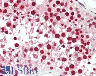 IHC-plus™ CCAR2 / KIAA1967 Antibody (aa875-C-term)