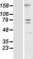 TMEM44 Protein (Over-Expression Lysate Myc-DDK (Flag))