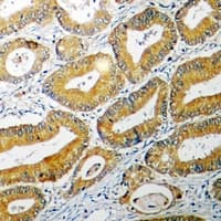 Polyclonal Rabbit anti-Human BID Antibody (Internal, IHC, IF, WB)