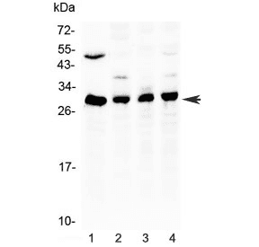 BCL2 / Bcl-2 Antibody