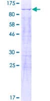 Human KHNYN Protein (Recombinant GST)
