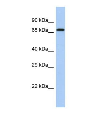 ACSL6 Antibody (C-Terminus)