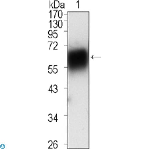 ROR1 Antibody