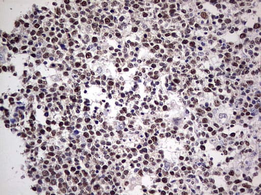 PCNA Antibody (clone OTI1A5)