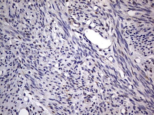 PRX-1 / PRRX1 Antibody (clone OTI1E10)