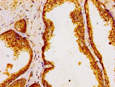 Polyclonal Rabbit anti-Human GOLPH3 Antibody (IHC, WB)