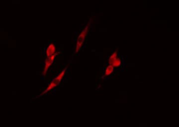 ADK / Adenosine Kinase Antibody