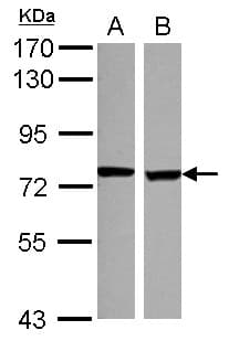 SCNN1D Antibody (Internal)