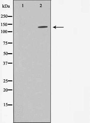 ADNP Antibody