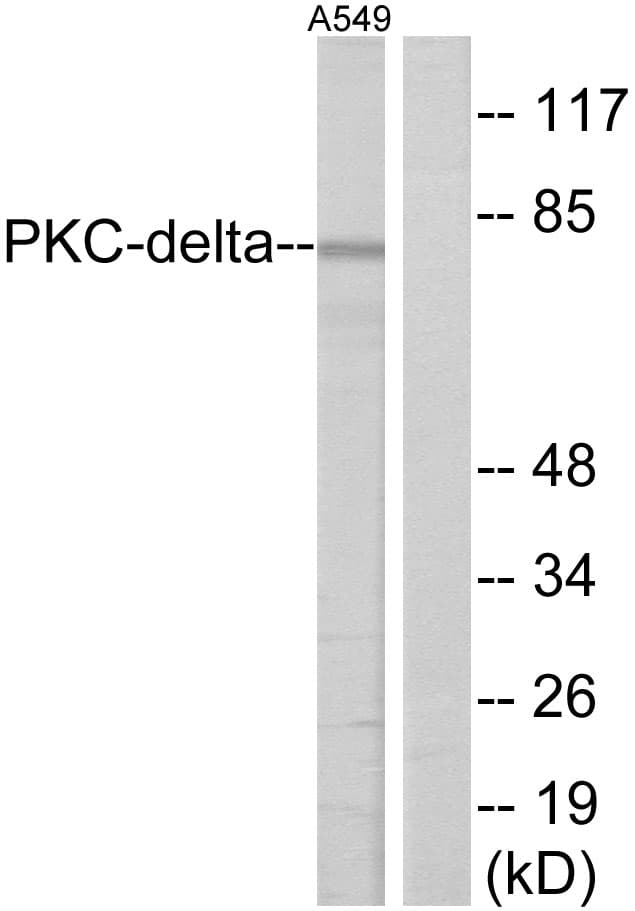 IHC-plus™ Polyclonal Rabbit anti-Human HSF1 Antibody (aa270-319, IHC, WB)