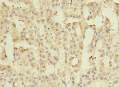 FAM149B1 Antibody