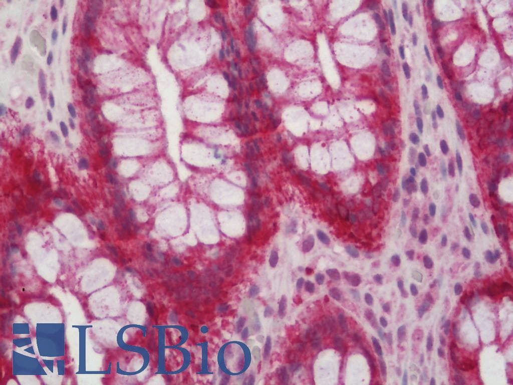 IHC-plus™ Polyclonal Rabbit anti-Human GABARAPL2 / ATG8 Antibody (IHC, IF, WB)
