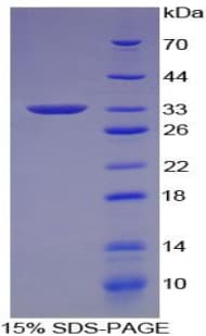 Human NCAM / CD56 Protein (Recombinant His, N-Terminal)