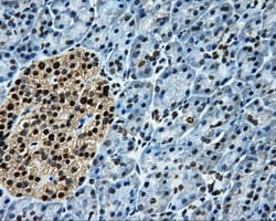 Monoclonal Mouse anti-Human LOX / Lysyl Oxidase Antibody (clone OTI6B11, IHC, IF, WB)