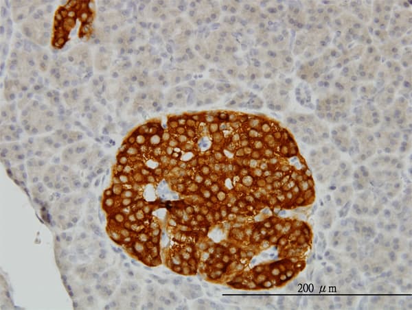 IHC-plus™ Monoclonal Mouse anti-Human RAB3B Antibody (clone 3F12, IHC, IF, WB)