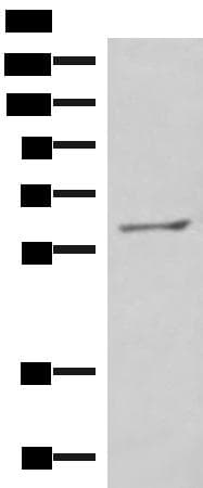 Polyclonal Rabbit anti-Human MBTPS2 Antibody (IHC, WB)