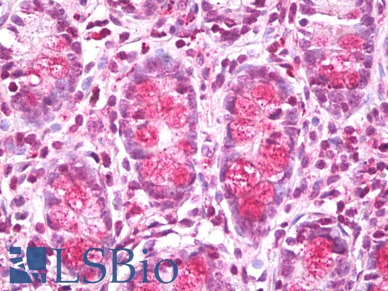 IHC-plus™ LIPA / Lysosomal Acid Lipase Antibody (aa150-300)