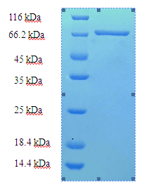 Human CCBL2 Protein (Recombinant His-SUMO)