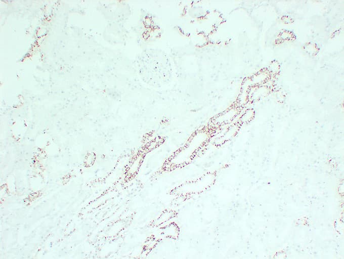 CLDN7 / Claudin 7 Antibody (clone ABT-CLD7)