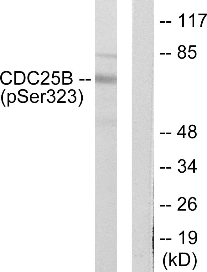 Polyclonal Rabbit anti-Human CDC25B Antibody (phospho-Ser323, WB)