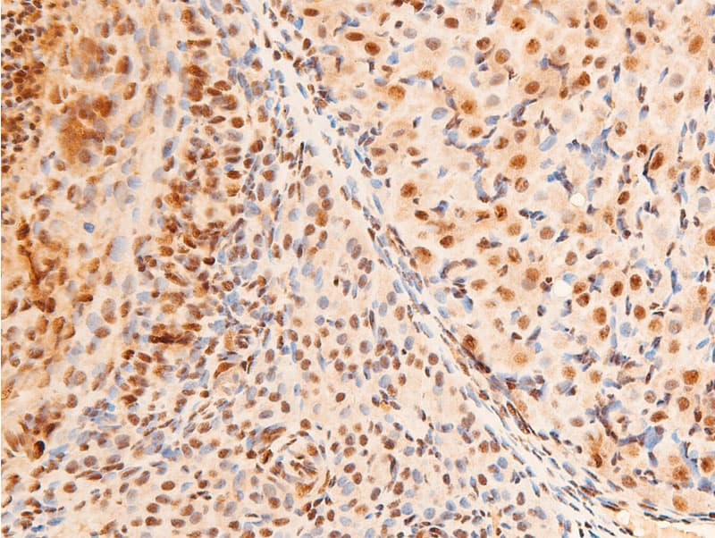 Polyclonal Rabbit anti-Human JUN / c-Jun Antibody (phospho-Thr91, IHC, WB)