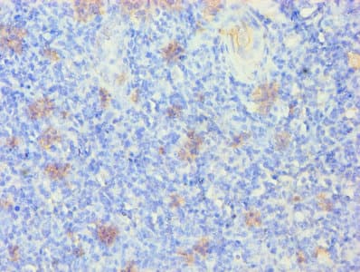 KRT14 / CK14 / Cytokeratin 14 Antibody (aa1-472)