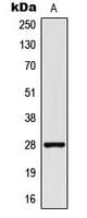 THY1 / CD90 Antibody (Internal)