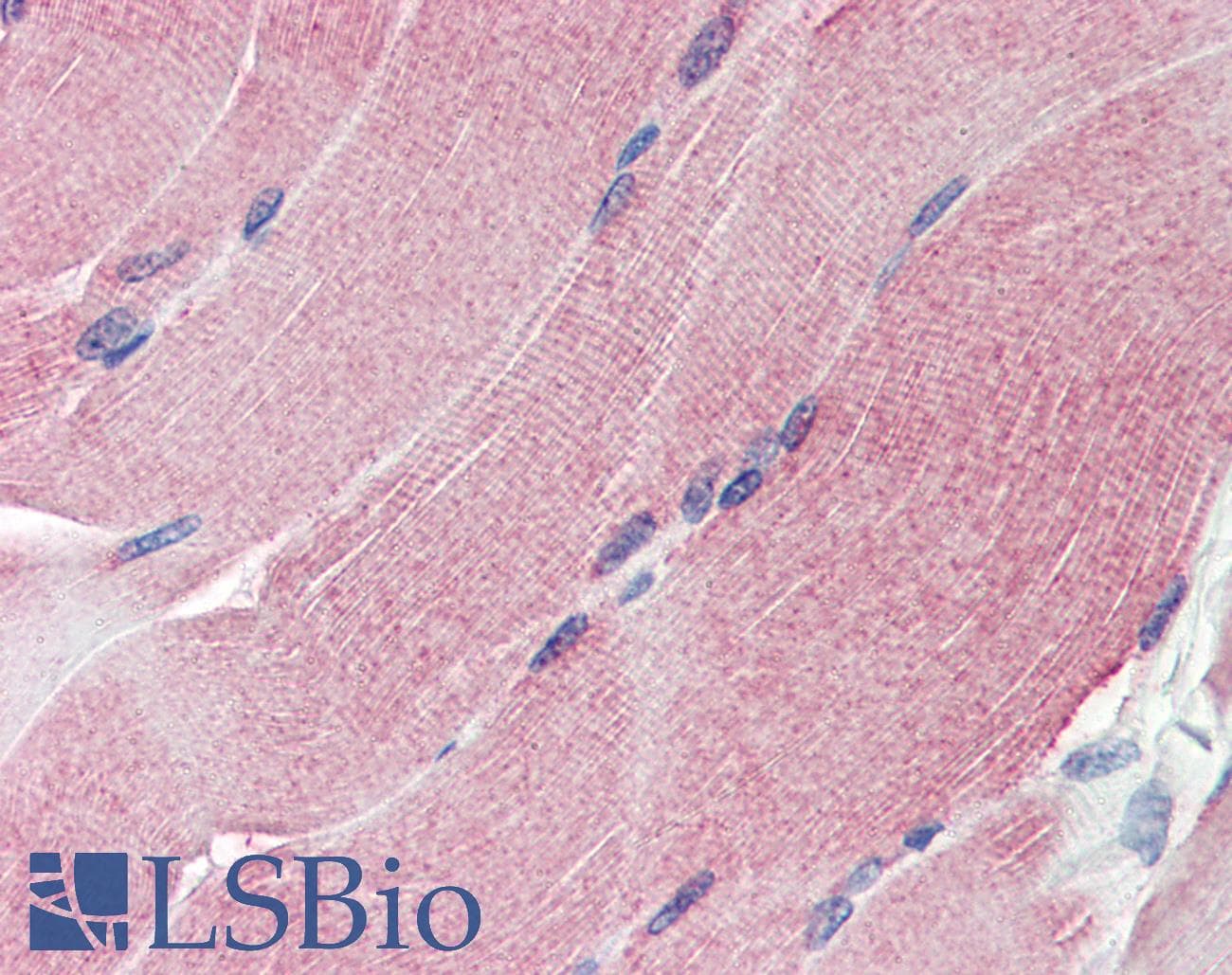 IHC-plus™ Monoclonal Mouse anti-Human THBS1 / Thrombospondin-1 Antibody (clone A6.1, Azide-free, IHC, IF, WB)
