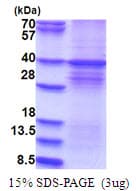 Human DYRK / DYRK1A Protein (Recombinant His)