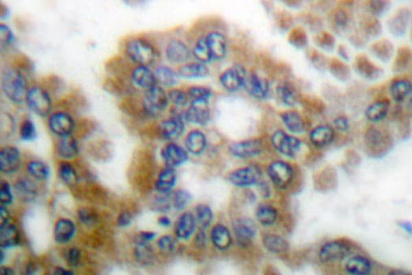 Polyclonal Rabbit anti-Human CRKL Antibody (Pro201, IHC, IF, WB)