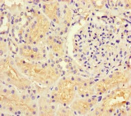 Polyclonal Rabbit anti-Human GUCY1A1 / GUCY1A3 Antibody (IHC, IF)