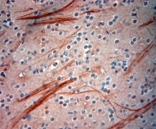 NEFH / NF-H Antibody (aa150-200)
