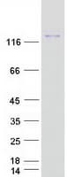 Human HEPH / Hephaestin Protein (Recombinant Myc-DDK (Flag))