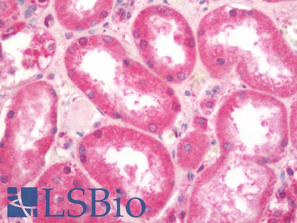IHC-plus™ C2CD3 Antibody