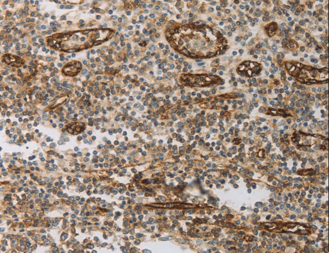 Polyclonal Rabbit anti-Human PECAM-1 / CD31 Antibody (IHC, WB)