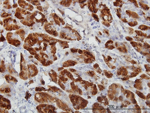 CTH / Cystathionase Antibody (clone S51)