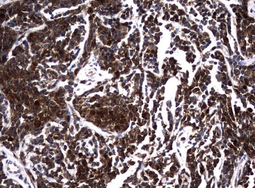 NME1 / NM23 Antibody (clone UMAB91)