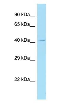 TMOD4 Antibody (aa25-74)